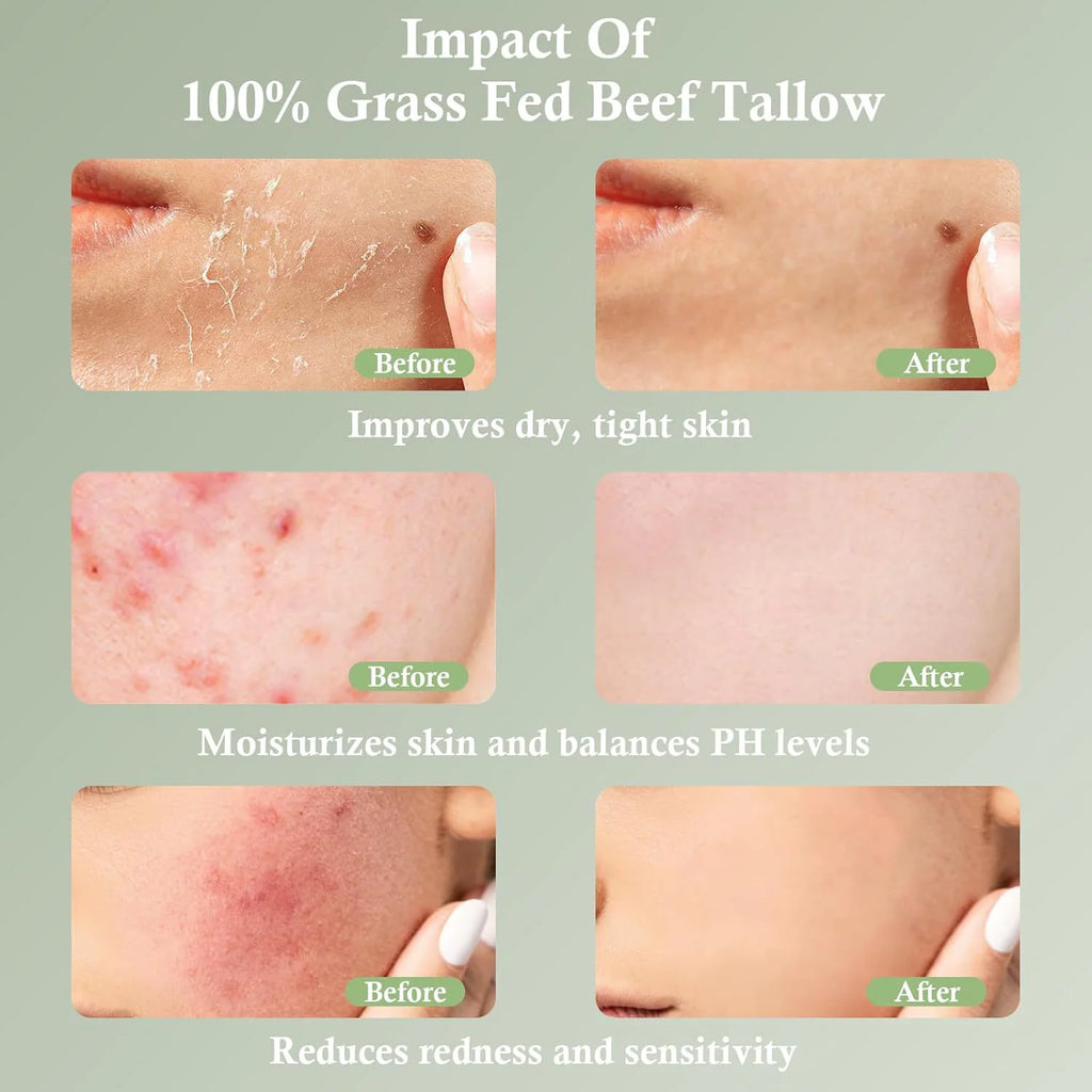 Feuchtigkeitscreme mit Talg von Weiderindern – Beruhigende und pflegende Hautpflege