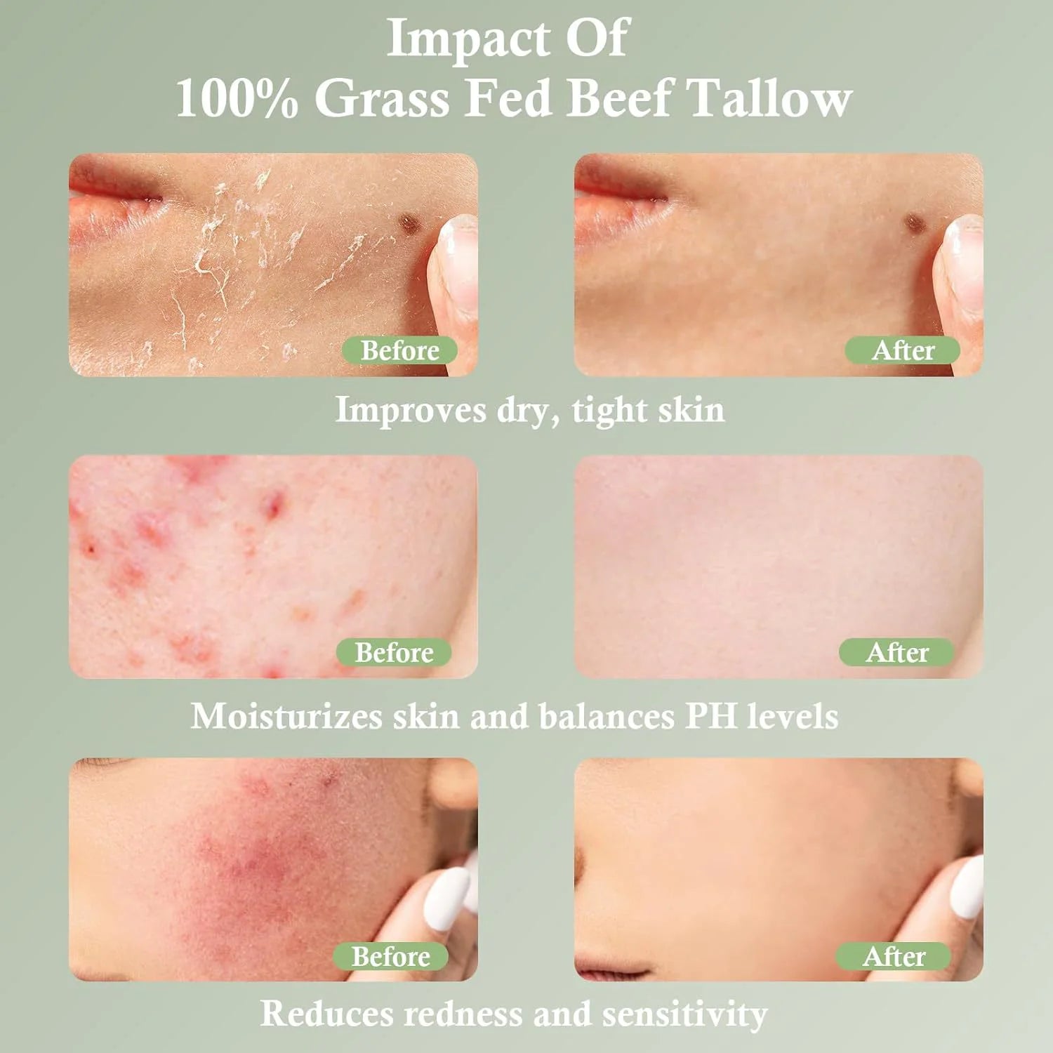 Feuchtigkeitscreme mit Talg von Weiderindern – Beruhigende und pflegende Hautpflege